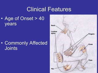 Clinical Features
• Age of Onset > 40
years
• Commonly Affected
Joints
 