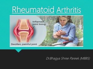 Rheumatoid Arthritis
Dr.Bhagya Shree Pareek (MBBS)
 