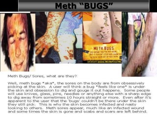 33
Meth “BUGS”
 