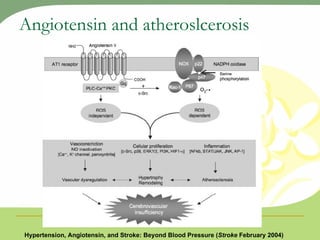 Angiotensin and atheroslcerosis Hypertension, Angiotensin, and Stroke: Beyond Blood Pressure ( Stroke  February 2004) 