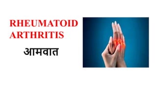 RHEUMATOID
ARTHRITIS
आमवात
 