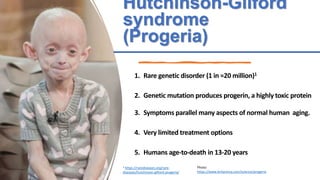 Hutchinson-Gilford
syndrome
(Progeria)
Photo:
https://www.britannica.com/science/progeria
1 https://rarediseases.org/rare-...