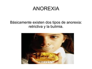 ANOREXIA Básicamente existen dos tipos de anorexia: retrictiva y la bulimia. 