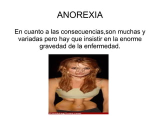 ANOREXIA En cuanto a las consecuencias,son muchas y variadas pero hay que insistir en la enorme gravedad de la enfermedad. 