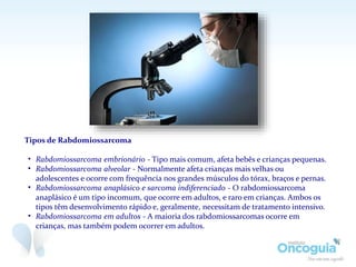 Tipos de Rabdomiossarcoma
• Rabdomiossarcoma embrionário - Tipo mais comum, afeta bebês e crianças pequenas.
• Rabdomiossarcoma alveolar - Normalmente afeta crianças mais velhas ou
adolescentes e ocorre com frequência nos grandes músculos do tórax, braços e pernas.
• Rabdomiossarcoma anaplásico e sarcoma indiferenciado - O rabdomiossarcoma
anaplásico é um tipo incomum, que ocorre em adultos, e raro em crianças. Ambos os
tipos têm desenvolvimento rápido e, geralmente, necessitam de tratamento intensivo.
• Rabdomiossarcoma em adultos - A maioria dos rabdomiossarcomas ocorre em
crianças, mas também podem ocorrer em adultos.
 