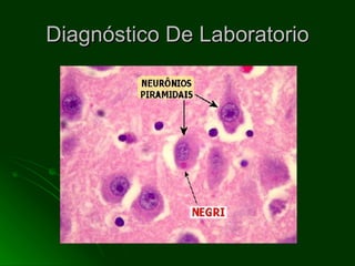 Diagnóstico De Laboratorio 