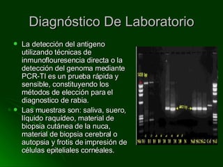 Diagnóstico De Laboratorio La detección del antigeno utilizando técnicas de inmunoflouresencia directa o la detección del genoma mediante PCR-TI es un prueba rápida y sensible, constituyendo los métodos de elección para el diagnostico de rabia. Las muestras son: saliva, suero, líquido raquídeo, material de biopsia cutánea de la nuca, material de biopsia cerebral o autopsia y frotis de impresión de células epiteliales cornéales. 