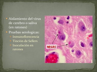Aislamiento del virus de cerebro o saliva (en ratones) Pruebas serologicas: Inmunoflorecencia  Tinción de Sellers  Inoculación en ratones  