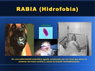 RABIA (Hidrofobia) Lissavirus Es una enfermedad zoonótica aguda, producida por un virus que ataca al sistema nervioso central y causa la muerte inevitablemente. 
