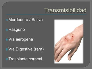  Mordedura    / Saliva

 Rasguño


 Vía   aerógena

 Vía   Digestiva (rara)

 Trasplante   corneal
 