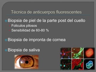  Biopsia   de piel de la parte post del cuello
  • Foliculos pilosos
  • Sensibilidad de 60-80 %


 Biopsia   de impronta de cornea

 Biopsia   de saliva
 