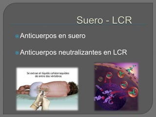  Anticuerpos   en suero

 Anticuerpos   neutralizantes en LCR
 