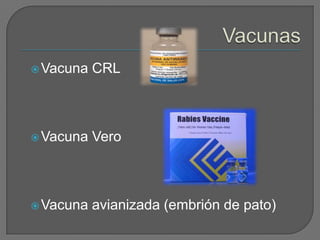  Vacuna   CRL



 Vacuna   Vero



 Vacuna   avianizada (embrión de pato)
 