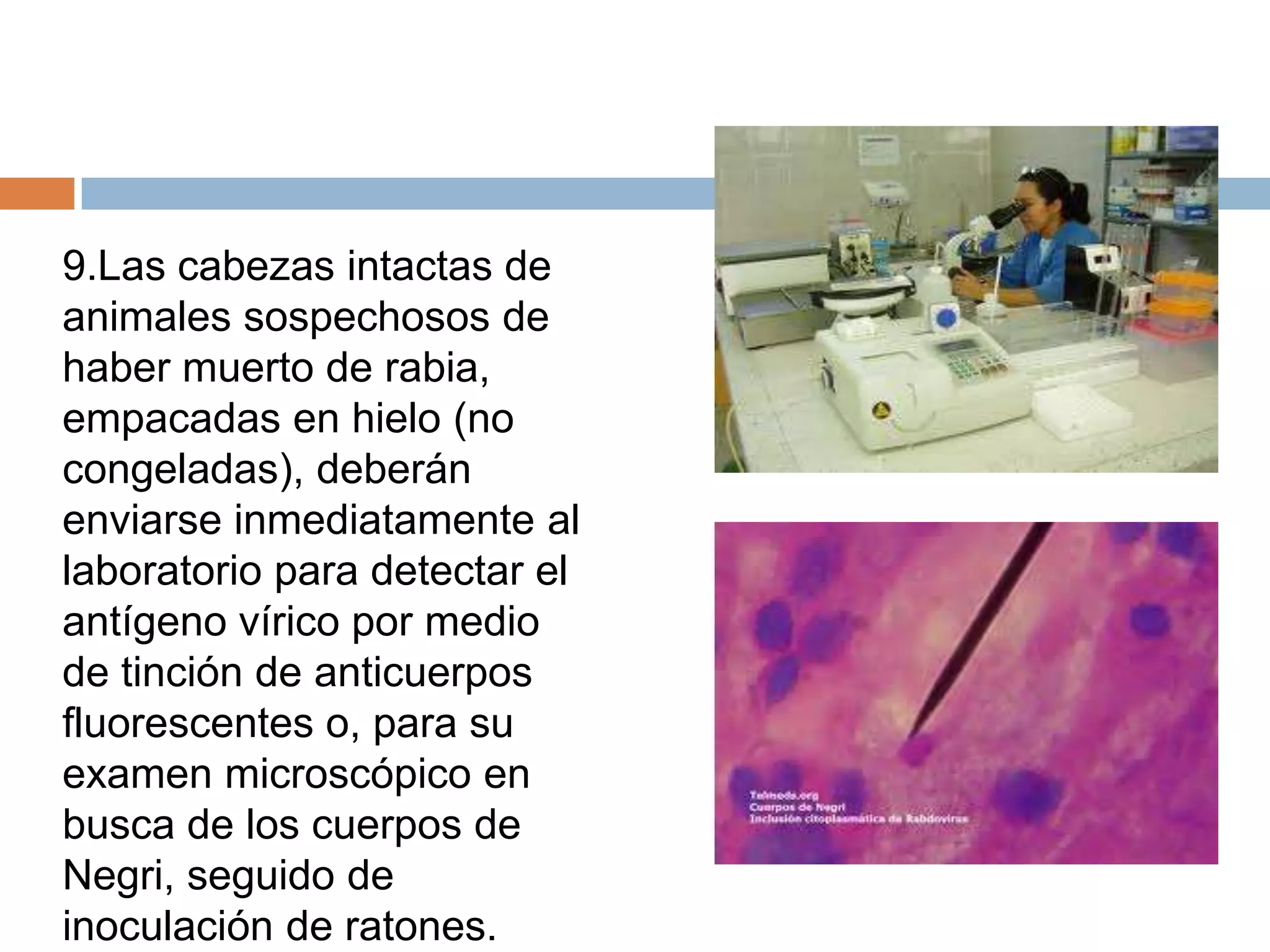 9.Las cabezas intactas de
animales sospechosos de
haber muerto de rabia,
empacadas en hielo (no
congeladas), deberán
enviarse inmediatamente al
laboratorio para detectar el
antígeno vírico por medio
de tinción de anticuerpos
fluorescentes o, para su
examen microscópico en
busca de los cuerpos de
Negri, seguido de
inoculación de ratones.
 