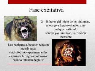 Fase excitativa
24-48 horas del inicio de los síntomas,
se observa hiperexcitación ante
cualquier estímulo
sonoro y/o luminoso, salivación
incesante
Los pacientes afectados rehúsan
ingerir agua
(hidrofobia), experimentando
espasmos faríngeos dolorosos
cuando intentan deglutir
http://www.sonperros.com/wp-content/uploads/2011/03/rabia.jpg
http://4.bp.blogspot.com/_x-edFP-
RfcA/SqWBv9eptOI/AAAAAAAAAQ4/IkF48aitoe4/s400/perro-
rabioso.jpg
 