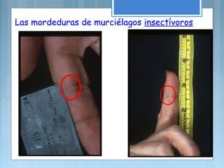 Las mordeduras de murciélagos insectívoros
 