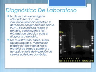 Diagnóstico De Laboratorio
 La detección del antigeno
utilizando técnicas de
inmunoflouresencia directa o la
detección del genoma mediante
PCR-TI es un prueba rápida y
sensible, constituyendo los
métodos de elección para el
diagnostico de rabia.
 Las muestras son: saliva, suero,
líquido raquídeo, material de
biopsia cutánea de la nuca,
material de biopsia cerebral o
autopsia y frotis de impresión de
células epiteliales cornéales.
 
