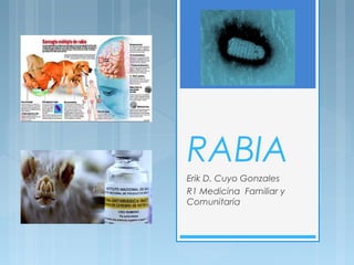 RABIA
Erik D. Cuyo Gonzales
R1 Medicina Familiar y
Comunitaria
 