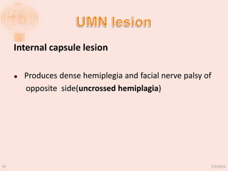 Internal capsule lesion
 Produces dense hemiplegia and facial nerve palsy of
opposite side(uncrossed hemiplagia)
7/3/201597
 
