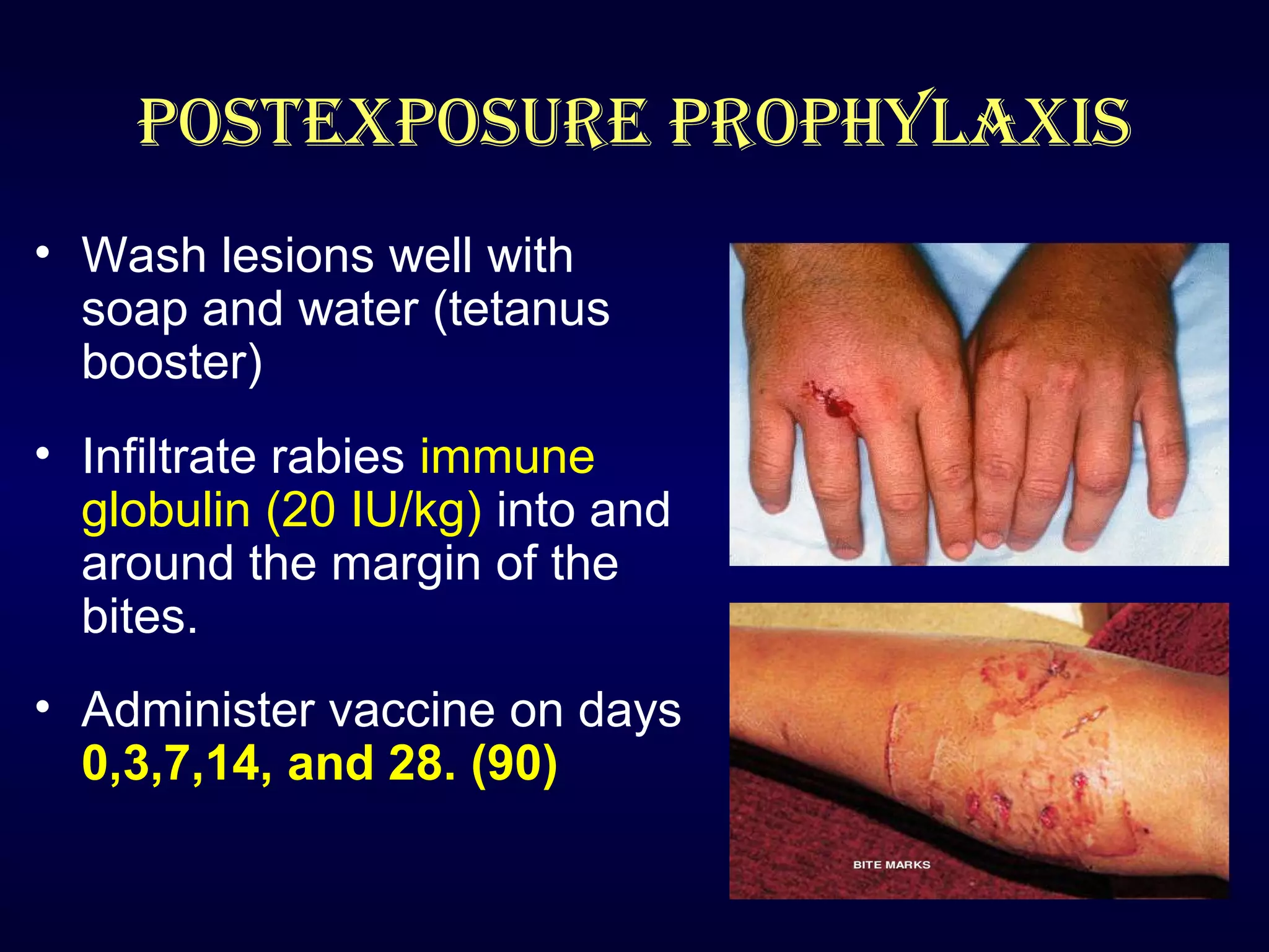 Rabies | PPT