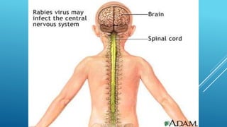 Partial Paralysis Rabies Rabies | PPTX