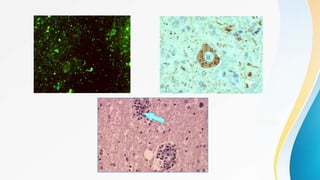 Rabies | PPTX
