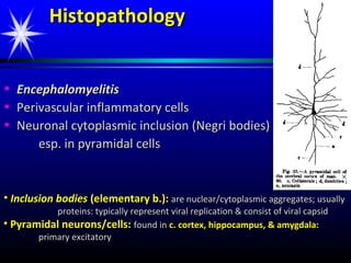 Rabies | PPT