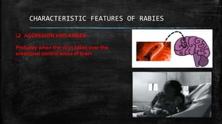 Rabies | PPTX