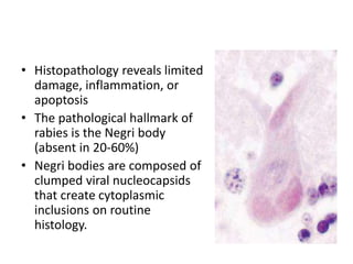 Rabies Inclusions Rabies | PPTX