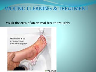 WOUND CLEANING & TREATMENT
Wash the area of an animal bite thoroughly
 