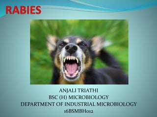 ANJALI TRIATHI
BSC (H) MICROBIOLOGY
DEPARTMENT OF INDUSTRIAL MICROBIOLOGY
16BSMBH012
 