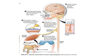 Problem Child Rabies Rabies in Children | PPTX