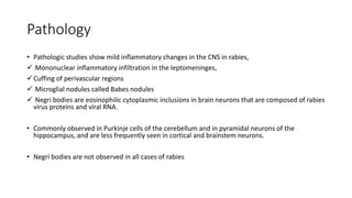 Pathology
• Pathologic studies show mild inflammatory changes in the CNS in rabies,
 Mononuclear inflammatory infiltration in the leptomeninges,
Cuffing of perivascular regions
 Microglial nodules called Babes nodules
 Negri bodies are eosinophilic cytoplasmic inclusions in brain neurons that are composed of rabies
virus proteins and viral RNA.
• Commonly observed in Purkinje cells of the cerebellum and in pyramidal neurons of the
hippocampus, and are less frequently seen in cortical and brainstem neurons.
• Negri bodies are not observed in all cases of rabies
 