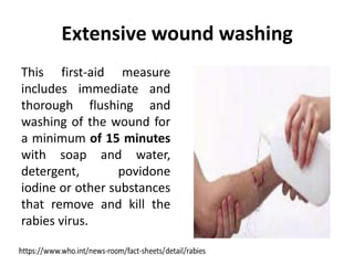 Extensive wound washing
This first-aid measure
includes immediate and
thorough flushing and
washing of the wound for
a minimum of 15 minutes
with soap and water,
detergent, povidone
iodine or other substances
that remove and kill the
rabies virus.
 