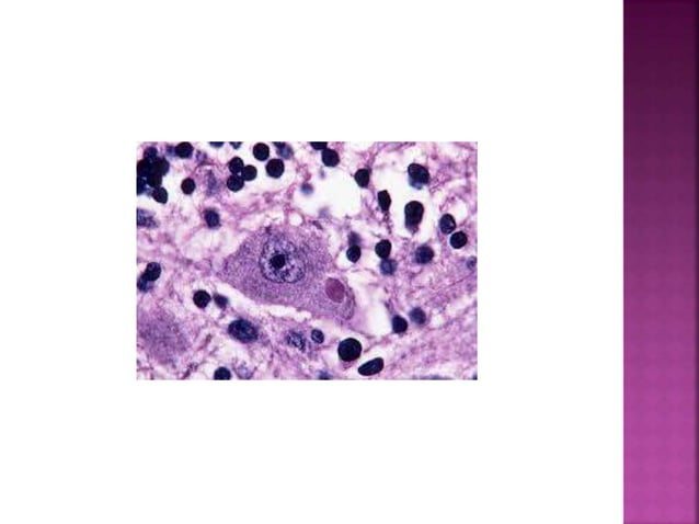 Rabies ,microbiology | PPTX