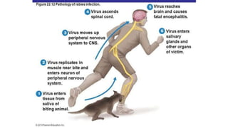 How Does Rabies Develop Rabies | PPTX