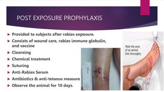 Rabies.pptx