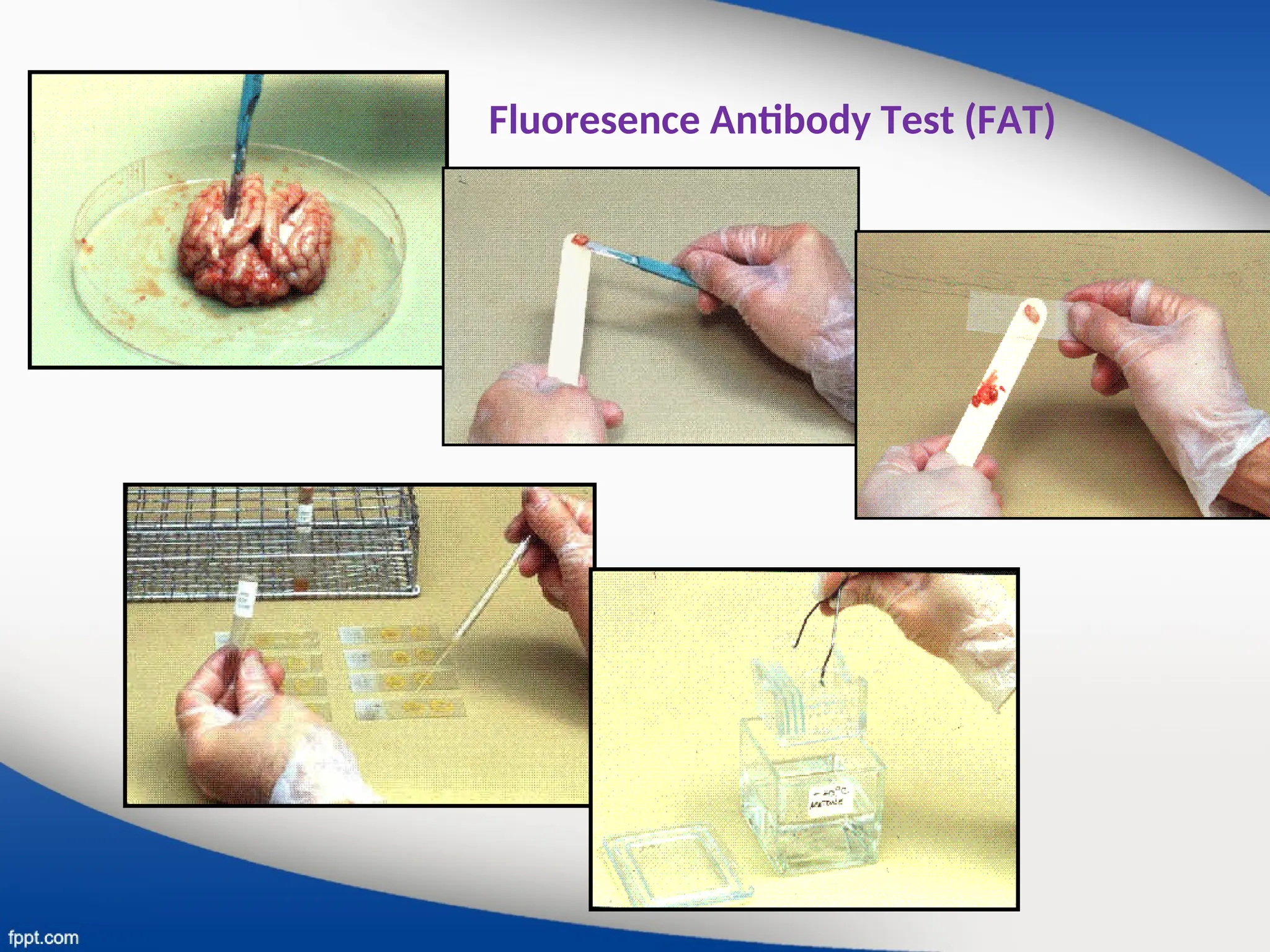 Fat Rabies Test Penanganan pencegahan tatalaksana Rabies.ppt