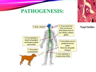 PATHOGENESIS:
Negri bodies
12
 