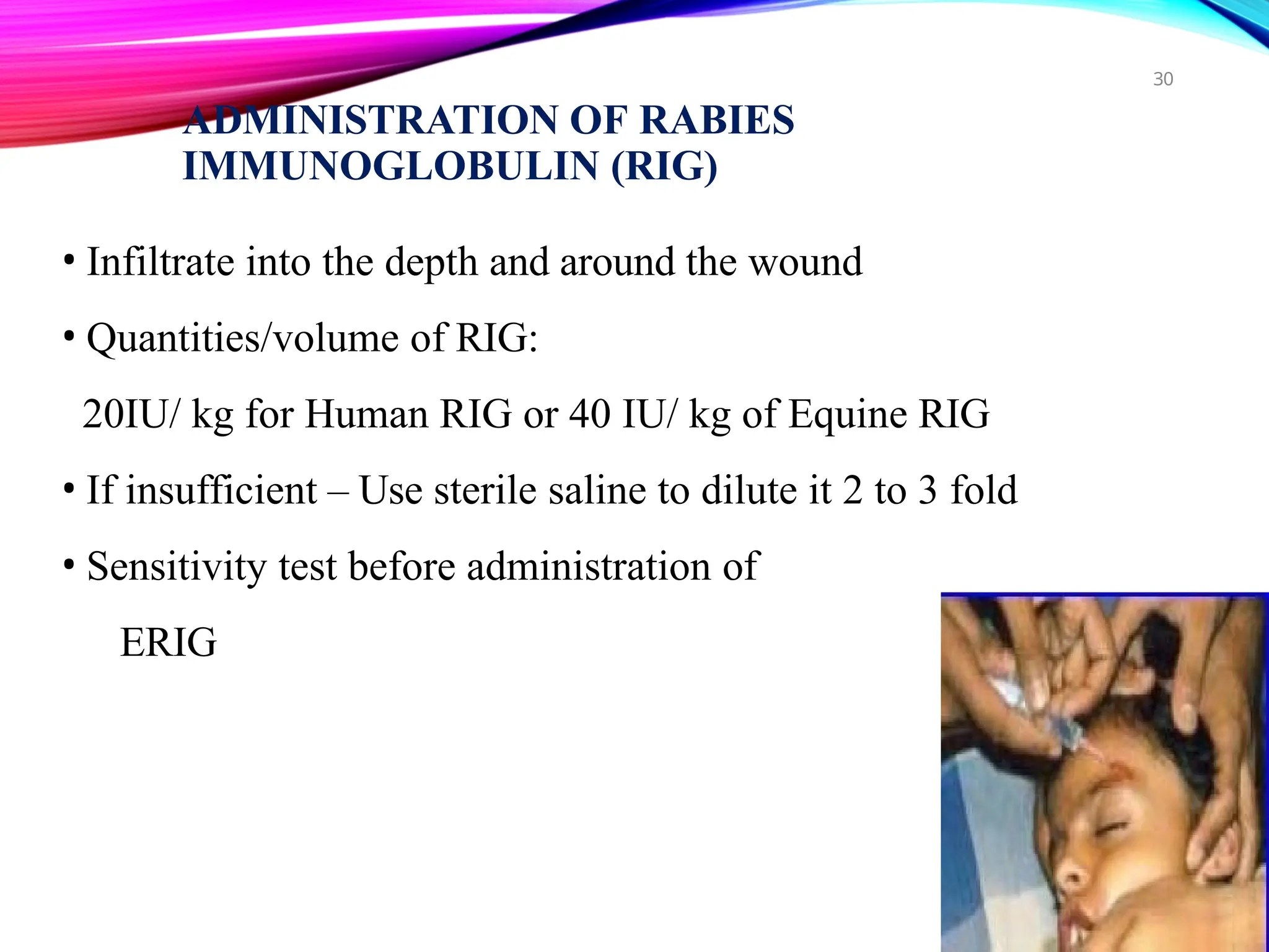 Rabies - clinical features/path/diag/treatment | PPTX