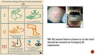 NB: All animal bites in forest or in the wild
should be treated as Category III
exposures.
 