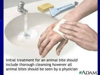 Rabies - Dr Akaki 20161129 | PPT