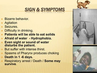 SIGN & SYMPTOMS
 Bizarre behavior.
 Agitation
 Seizures.
 Difficulty in drinking.
 Patients will be able to eat solids
 Afraid of water - Hydrophobia.
 Even sight or sound of water
disturbs the patient.
 But suffer with intense thirst.
 Spasms of Pharynx produces choking
 Death in 1 -6 days.
 Respiratory arrest / Death / Some may
survive.
 