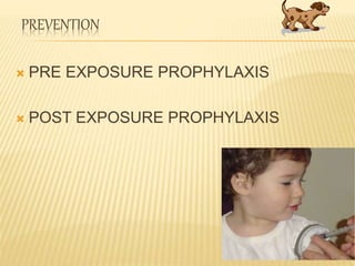 PREVENTION
 PRE EXPOSURE PROPHYLAXIS
 POST EXPOSURE PROPHYLAXIS
 