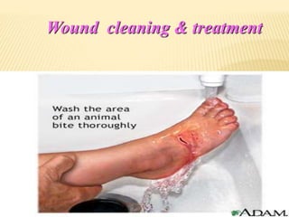 Wound cleaning & treatment
 