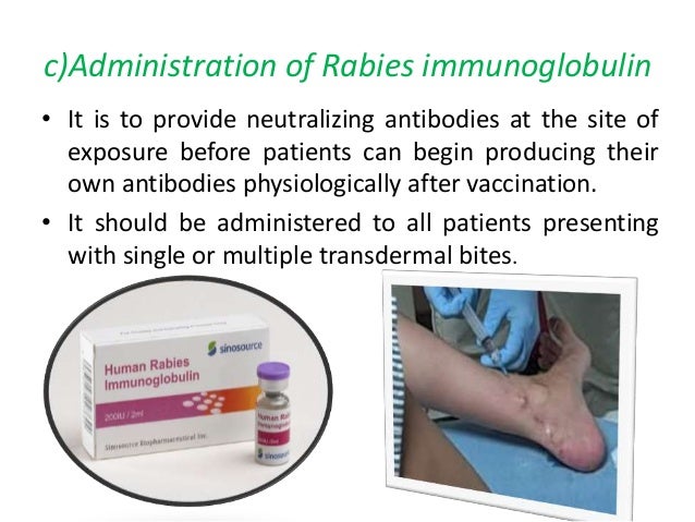 Rabies prevention and control Rabies prevention and control