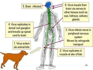 Partial Paralysis Rabies rabiesteaching.pptx