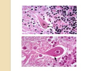 Rabies virus | PPTX