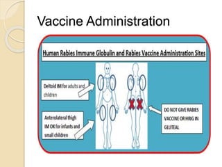 Rabies Virus In Humans