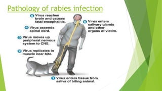 Fever From Rabies RABIES VIRUS.pptx